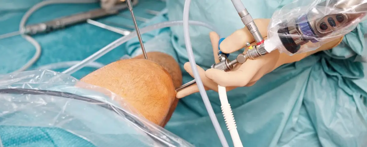 Athroskopische Knie Operation